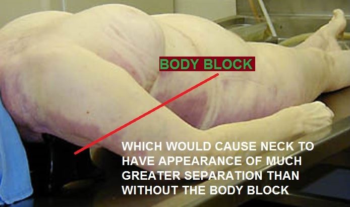 body block